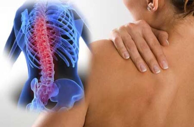 چھاتی کی ریڑھ کی ہڈی کے osteochondrosis کے بڑھنے کے دوران، ڈورساگو درد ہوتا ہے